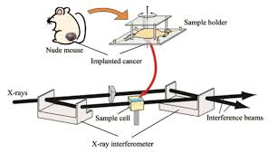 u16 nude ls|イモータル・アイアンフィスト