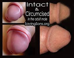 Intact circumcised adult jpg 254x640 Circumcised cock