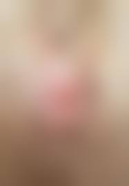 разрыв пизды|Разрыв пизды крупным планом толстой женщины (60 фото) - секс и порно  chohanpohan.com