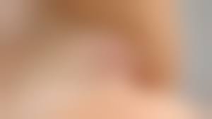 teens topless cameltoe|KindGirls photo 9 of 16