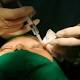 Cosmetic surgery crackdown: Urgent action needed by states to protect patients, surgeons say 