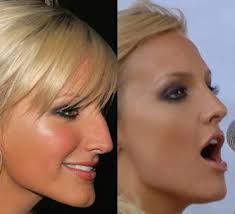Can you spot the difference?