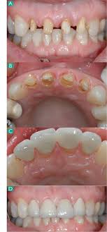 Special treatment at the dental hygienist for this patient jpg x Quarter type dental hygienist