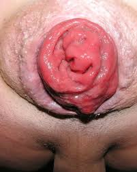 Porn anal prolapse squirting gaping hole watch online jpg x Gaping prolapse