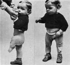 child in erection| / X