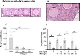 Pre pubertal girls nude |Implementation of ovarian tissue cryopreservation in Hong Kong | HKMJ