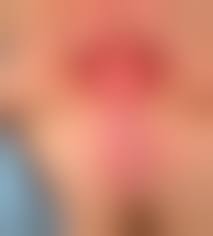 prepubertAL VAGINA|4. Longstanding Prepubertal Vaginal Bleeding in an 8 year old Secondary to  Genital Self-Mutilation
