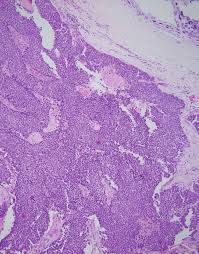 jeon boram fake nude|Korean girls - Jeon Boram | Facebook