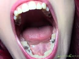 Videos teeth fetish jpg x Teeth fetish