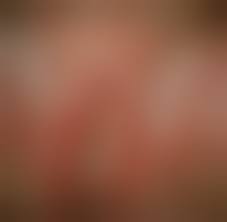  child labia hymen|Pediatric and Adolescent Gynecology | Obgyn Key