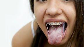 Braces porn videos free vids tiava jpg x With braces