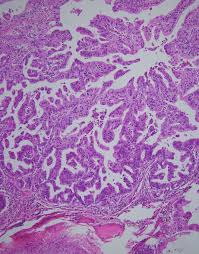 kim hee ae fake nude|Abstract Book Small Book_2013