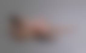 quad amputee nude|Nude amputee by ura04081969 on DeviantArt