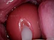 Camera inside vagina video jpg x Camera inside vagina