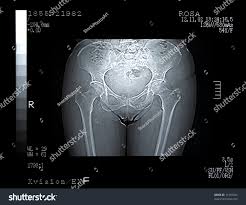MRI まんこ|画像】MRIで男女がセ○クスしてる所を見たら凄い事になってた - ポッカキット