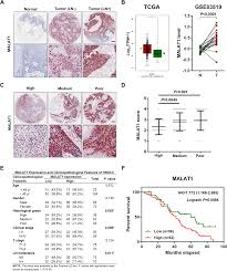 ls- nude lsm 6|Salento Railroad rail model shop - LS Models 10326 electric locomotive SNCF  CC 6548 Lyon Mouche depot green livery Epoch IV