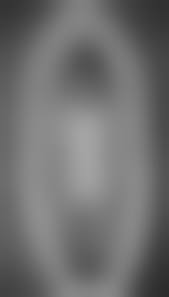 naked dead girl corpse nude|Rule 34 - 1girls asphyxiation bed blood breasts brown eyes brown hair corpse  dead death empty eyes female death medium breasts nipples nude open eyes  solo strangling | 947660