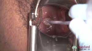 child examination vagina|Preparing Your Daughter for Her First Pelvic Exam - Revere Health