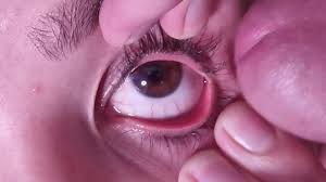 Cum in her eye jpg x Cum in her eye