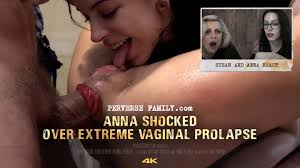 Anal prolapse fuck creampie porn videos faphouse jpg x Prolapse fucking