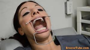 Kokone teeth fetish jpg x Teeth fetish