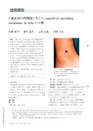 女児症例|EMA症例83：3月症例 5歳女児 ずっと右を向いている | EM Alliance