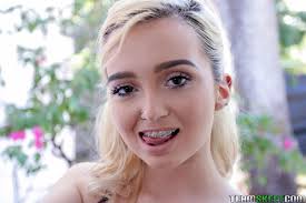 Free girl with braces porn videos from thumbzilla jpg x Girl with braces