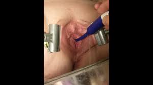 Urethral sex jpg x Urethral sex