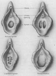 Hymen vagina|Hymen: Anatomy, Function, and Virginity Explained