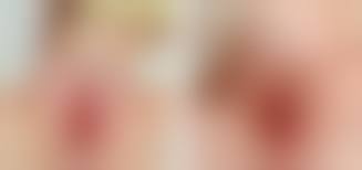 hymen child|SurgInfo - The hymen is a thin piece of mucosal tissue that surrounds or  partially covers the external vaginal opening. It forms part of the vulva,  or external genitalia, and is similar