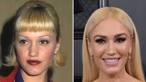 Gwen stefani plastic surgery jpg x Gwen stefani