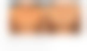 mini tits|Motivaミニ乳乳増殖後4日🍒スワイプして前に! She chose 160 cc motiva mini ergonomix implants  with fat transfer for this look & minimal downtime.