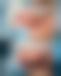 Отрезание пениса|Запущенный фимоз на фоне сахарного диабета - фото До и После операции в  клинике «Открытая урология»