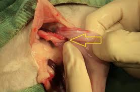 子宮脱|骨盤臓器脱手術 │ 婦人科 │ 診療科・専門外来 │ 医療法人明理会 行徳総合病院