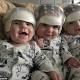 New York triplets get same surgery for rare skull condition 