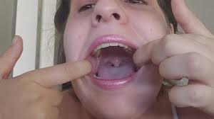 Easaatbwx oaajjkixlur skx jpg x Teeth fetish