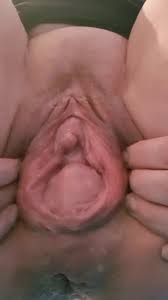 Squirting and prolapse pussy pornzog free porn clips jpg x Pussy prolapse