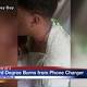 Man sleeping with charging iPhone suffers severe burns 