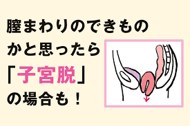 子宮脱|骨盤臓器脱手術を受けたら性行為は大丈夫？ 十分に配慮しています。│よくわかる骨盤臓器脱
