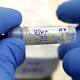 UW doctor quietly warns pregnant women about Zika risk in U.S. 
