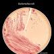 CDC investigating multistate E. coli outbreak linked to ground beef 