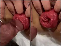 Prolapse fucking jpg x Prolapse fucking