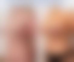 young pointy tits|Tuberous Breasts in Women: How They Form and How To Correct Them