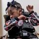 4-Year-Old Girl Suffers 'Severe Brain Injury' at Dentist's Office, Documents Say 