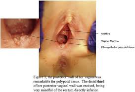 prepubertAL VAGINA|Abnormal Findings Diagnostic of Anogenital Trauma in Prepubertal Children |  SpringerLink