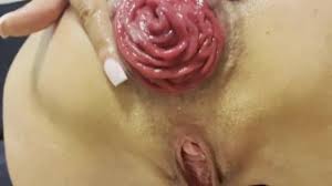 Prolapse anal fucking and prolapse tit fucking jpg x Prolapse fucking