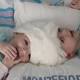 Mother of twins conjoined at head holds son for first time 