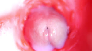 Endoscope inside pussy on live cam jpg x Camera in pussy