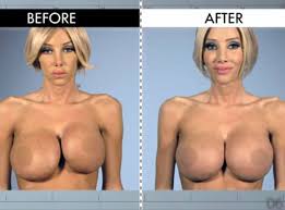 Adult film stars porn stars before jpg x Before and after