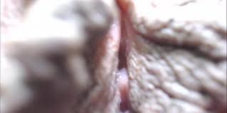 Enormous clit jpg x Enormous clit